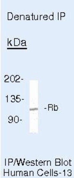 Rb Monoclonal Antibody (1F8 (Rb1)), Invitrogen 500 &mu;L; Unconjugated:Antibodies,