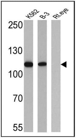 Rb Monoclonal Antibody (1F8 (Rb1)), Invitrogen 500 &mu;L; Unconjugated:Antibodies,