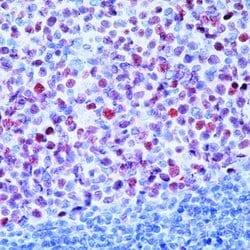 Invitrogen BCL6 Monoclonal Antibody (BL6.02 (PG-B6p)) 500 &mu;L; Unconjugated:Antibodies,