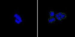 E-cadherin Monoclonal Antibody (DH01 (DCS-266)), Invitrogen 500 &mu;L;