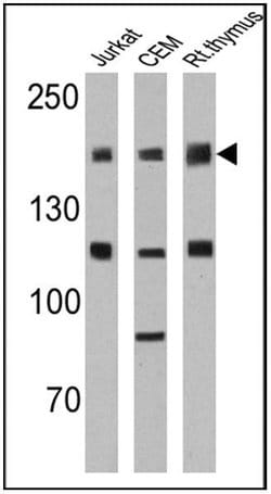 Invitrogen CD45RO Monoclonal Antibody (UCHL1) 500 &mu;L; Unconjugated:Antibodies,