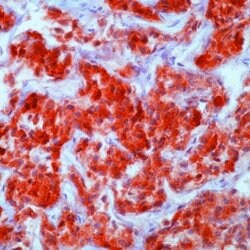 Invitrogen GnRHR Monoclonal Antibody (GNRH03) 500 &mu;L; Unconjugated:Antibodies,
