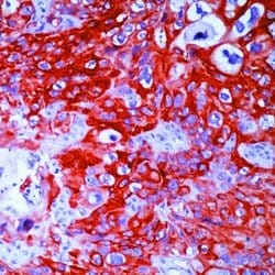 Invitrogen Cytokeratin 14 Monoclonal Antibody (LL002) 500 &mu;L; Unconjugated:Antibodies,
