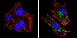 Invitrogen HLA-ABC Monoclonal Antibody (W6/32) 200 &mu;L; Unconjugated:Antibodies,