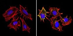 Invitrogen HLA-ABC Monoclonal Antibody (W6/32) 200 &mu;L; Unconjugated:Antibodies,