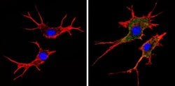 Invitrogen HLA-ABC Monoclonal Antibody (W6/32) 200 &mu;L; Unconjugated:Antibodies,