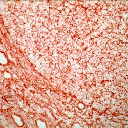Invitrogen HLA-ABC Monoclonal Antibody (W6/32) 200 &mu;L; Unconjugated:Antibodies,