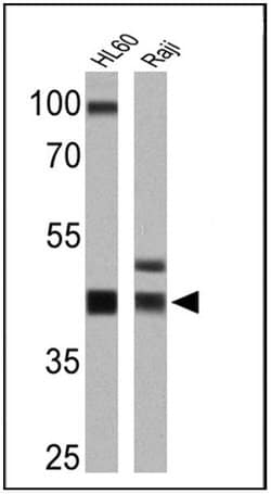 Invitrogen HLA-ABC Monoclonal Antibody (W6/32) 200 &mu;L; Unconjugated:Antibodies,