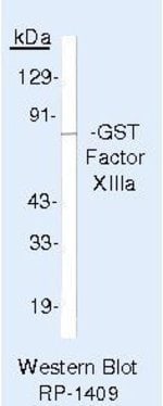 Factor XIII A Monoclonal Antibody (AC-1A1), Invitrogen™