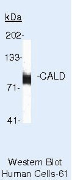 Caldesmon Monoclonal Antibody (l-CALD), Invitrogen 500 &mu;L; Unconjugated:Anticuerpos