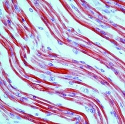 TPM1 Monoclonal Antibody (CH1), Invitrogen 500 &mu;L | Buy Online | Thermo Scientific | Fisher Scientific