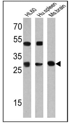 PR3 Monoclonal Antibody (MCPR3-2), Invitrogen 500 &mu;L; Unconjugated:Antibodies,