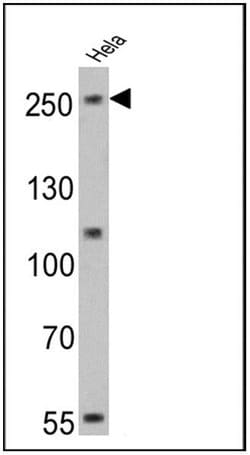 NOTCH1 Monoclonal Antibody (A6):Antibodies, Monoclonal