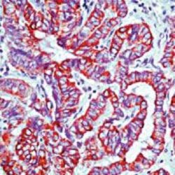 Invitrogen Cytokeratin 7 Monoclonal Antibody (OV-TL 12/30) 500 &mu;L; Unconjugated:Antibodies,