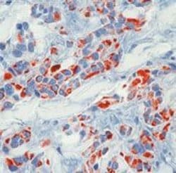 Invitrogen Cytokeratin 18 Monoclonal Antibody (DC10) 500 &mu;L; Unconjugated:Antikroppar
