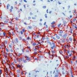 Mesothelioma Monoclonal Antibody (HBME-1), Invitrogen 500 &mu;L; Unconjugated:Antibodies,
