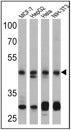 PTEN Monoclonal Antibody (17.A), Invitrogen 500 &mu;L; Unconjugated:Antibodies,