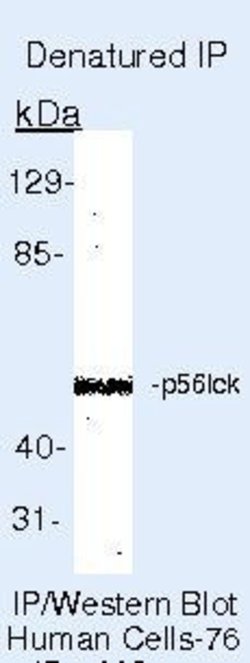 LCK Monoclonal Antibody (3A5), Invitrogen 500 &mu;L | Buy Online | Invitrogen | Fisher Scientific