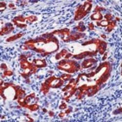 Invitrogen Cytokeratin 19 Monoclonal Antibody (BA17) 500 &mu;L | Buy Online | Invitrogen&trade; | Fisher Scientific