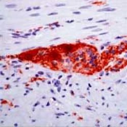 PGP9.5 Monoclonal Antibody (10A1), Invitrogen 500 &mu;L; Unconjugated:Antibodies,