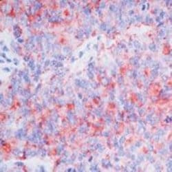 CA125, clone: M11, Invitrogen 500&mu;L; Unconjugated:Antibodies, Monoclonal