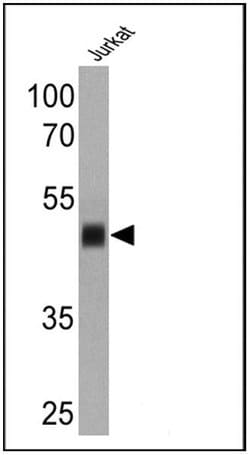 Invitrogen CD1a Monoclonal Antibody (O10) 500 &mu;L; Unconjugated:Antibodies,