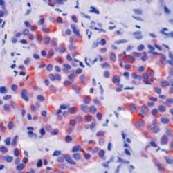 Invitrogen Cytokeratin 5 Monoclonal Antibody (XM26) 500 &mu;L; Unconjugated:Antibodies,
