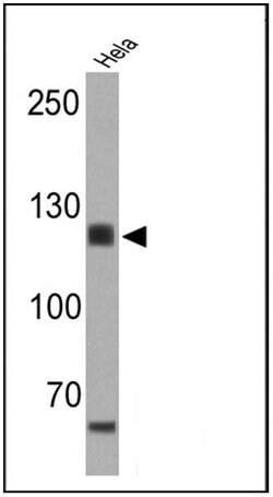 CD30 Monoclonal Antibody (CON6D/ C2), Invitrogen 500 &mu;L | Buy Online | Thermo Scientific | Fisher Scientific
