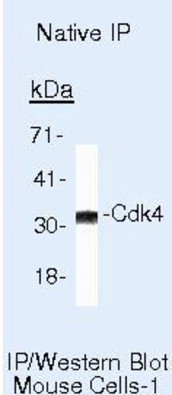 Cyclin D2 Monoclonal Antibody (DCS-3.1), Invitrogen 500 &mu;L | Buy Online | Invitrogen | Fisher Scientific
