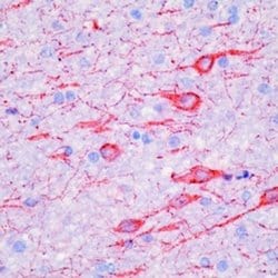 MAP2 Monoclonal Antibody (AP20), Invitrogen 500 &mu;L; Unconjugated:Antibodies,