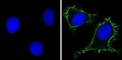Invitrogen RPSA Monoclonal Antibody (MLuC5) 500 &mu;L; Unconjugated:Antibodies,