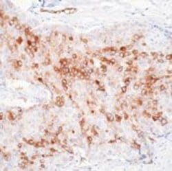Invitrogen RPSA Monoclonal Antibody (MLuC5) 500 &mu;L; Unconjugated:Antibodies,