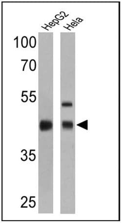 Invitrogen RPSA Monoclonal Antibody (MLuC5) 500 &mu;L; Unconjugated:Antibodies,