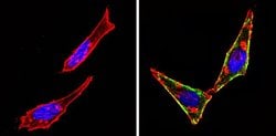 Invitrogen c-Kit Monoclonal Antibody (K45) 500 &mu;L; Unconjugated:Antibodies,