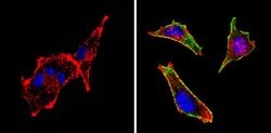 Invitrogen c-Kit Monoclonal Antibody (K45) 500 &mu;L; Unconjugated:Antibodies,