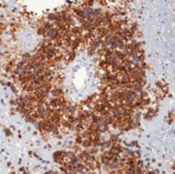 CD99 Monoclonal Antibody (HO36-1.1), Invitrogen 500 &mu;L; Unconjugated:Antibodies,