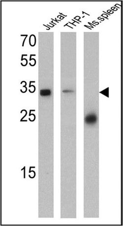 CD99 Monoclonal Antibody (HO36-1.1), Invitrogen 500 &mu;L; Unconjugated:Antibodies,
