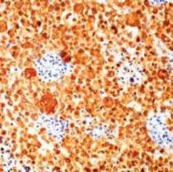 Invitrogen S100 Monoclonal Antibody (4C4.9) 500 &mu;L; Unconjugated:Antibodies,