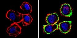 ErbB2 (HER-2) Monoclonal Antibody (N24), Invitrogen 500 &mu;L; Unconjugated:Antibodies,