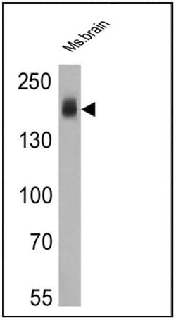 ErbB4 Monoclonal Antibody (H4.72.8 (Ab72)), Invitrogen 500 &mu;L; Unconjugated:Antibodies,