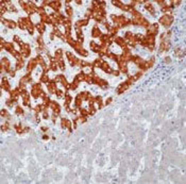 Hepatitis B Virus Surface Monoclonal Antibody (T9), Invitrogen™ 500 μL