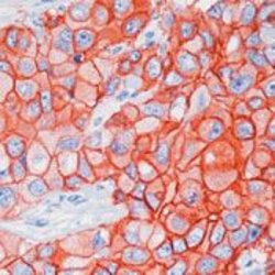 ErbB2 (HER-2) Monoclonal Antibody (e2-4001), Biotin, Invitrogen 500 &mu;L;