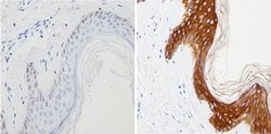 Invitrogen Cytokeratin Pan Antibody Cocktail 500 &mu;L; Unconjugated:Antibodies,