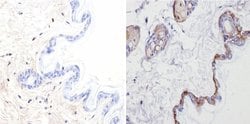 Invitrogen Cytokeratin Pan Antibody Cocktail 500 &mu;L; Unconjugated:Antibodies,