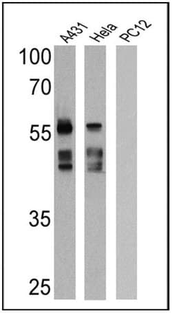 Invitrogen Cytokeratin Pan Antibody Cocktail 500 &mu;L; Unconjugated:Antibodies,