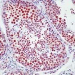 DNA-PK Monoclonal Antibody (42-psc (42-26, 42-27)), Invitrogen 500 &mu;L;