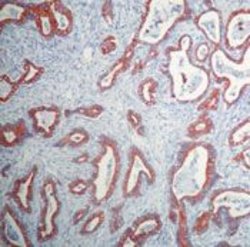 Invitrogen Cytokeratin 20 Monoclonal Antibody (Ks20.8) 500 &mu;L; Unconjugated:Antibodies,