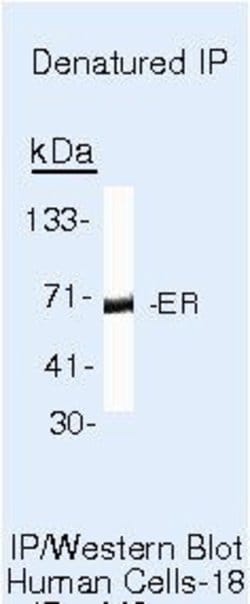 Estrogen Receptor alpha Monoclonal Antibody (6F11), Invitrogen 500 &mu;L;