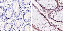 Cdk6 Monoclonal Antibody (K6.83 (DCS-83)), Invitrogen 500 &mu;L; Unconjugated:Antibodies,