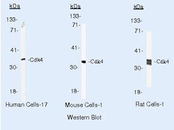 Cdk4 Monoclonal Antibody (DCS-31), Invitrogen 500 &mu;L | Buy Online | Invitrogen | Fisher Scientific